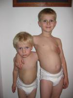 Cute kids with autism, some in diaper